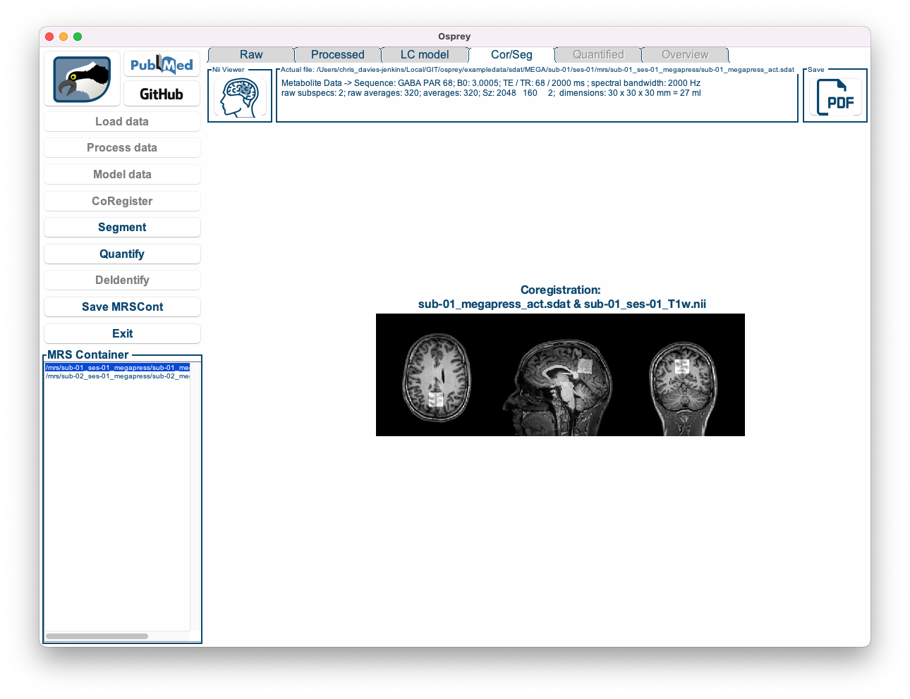 The Osprey GUI after OspreyCoReg.